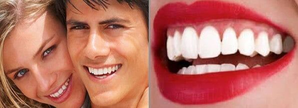 Teeth whitening treatment